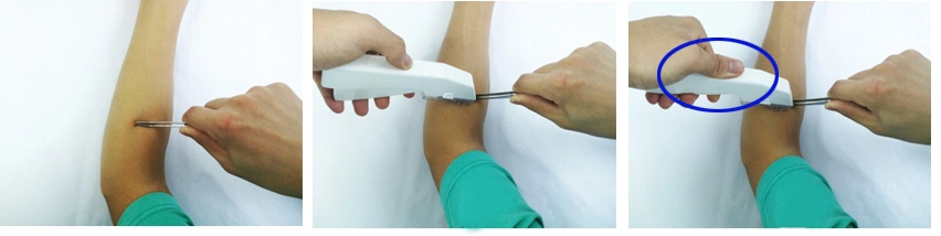 Disposable Medical Skin Surgical Staplers and Stapler Removers with CE