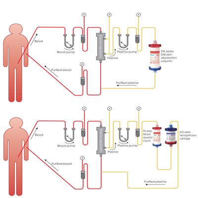 New Generation Blood Dialysis Machine 0～700mL/min Blood Flow With CE 0