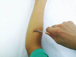 Streamlined Trauma Disposable Surgical Stapler Skin Stitching Stapler